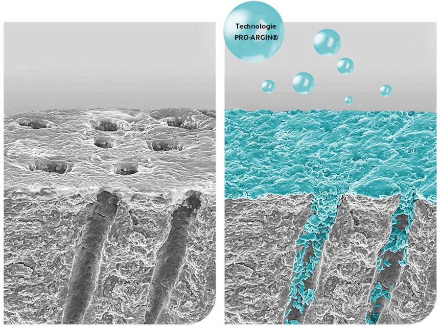 PRO-ARGIN Technologie